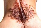Understanding Skin Parasite Myths and Digital Manipulation: Separating Fact from Fiction